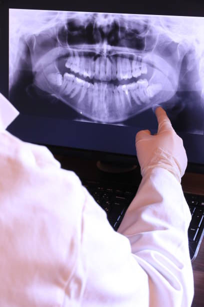 Best Emergency Dental Care for Abscessed Tooth in Hebron, PA